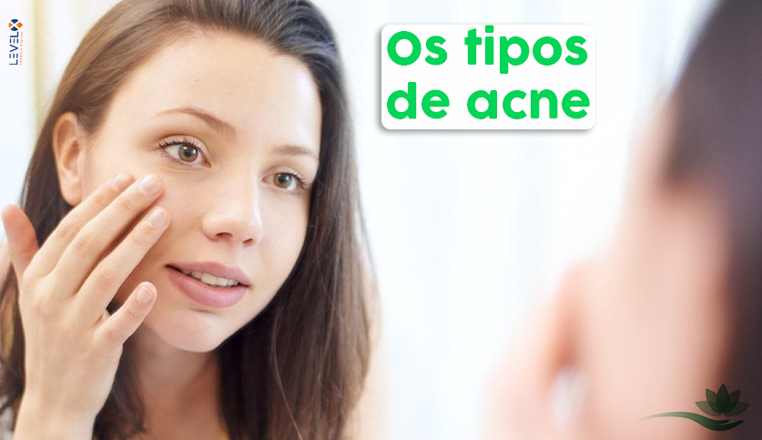 Os tipos de acne - Clínica de Estética Result em Londrina-PR